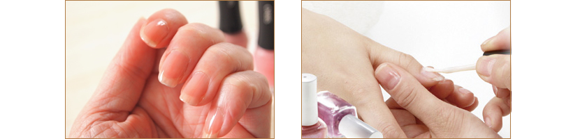 ネイルケアの写真